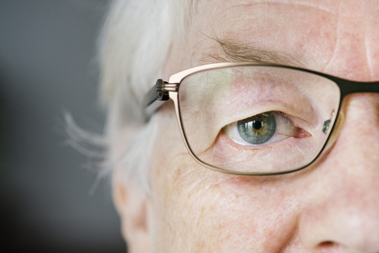 DMAE degeneración macular asociada a la edad