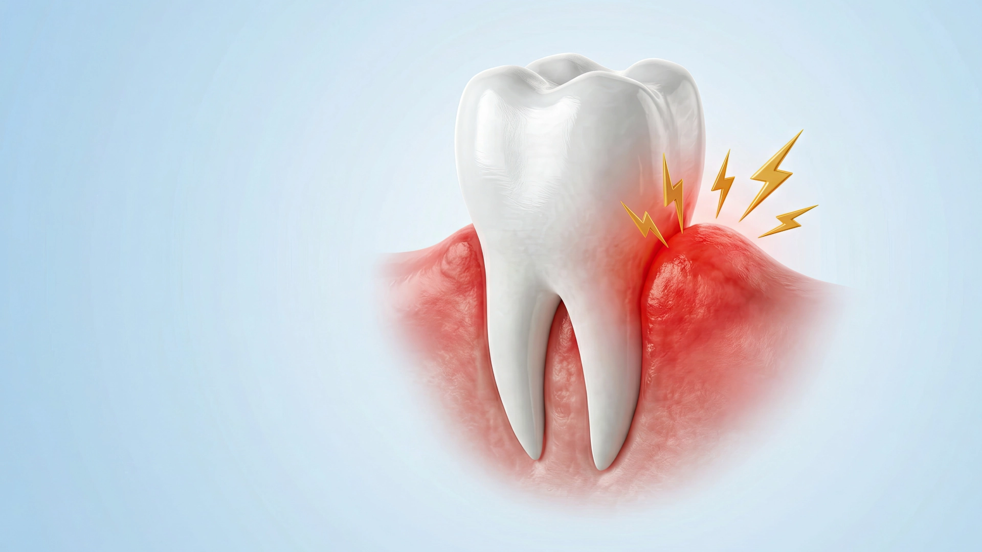 Gingivitis: una señal de alerta de la salud de tus encías
