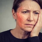 Neuralgia del trigémino